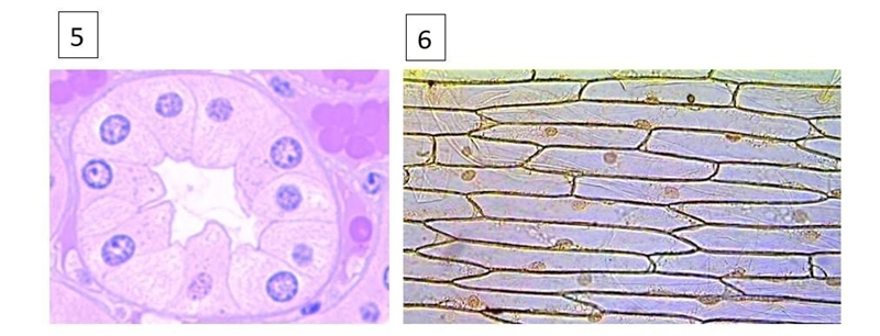 What type of cells are these? (Plant or animal)-example-1