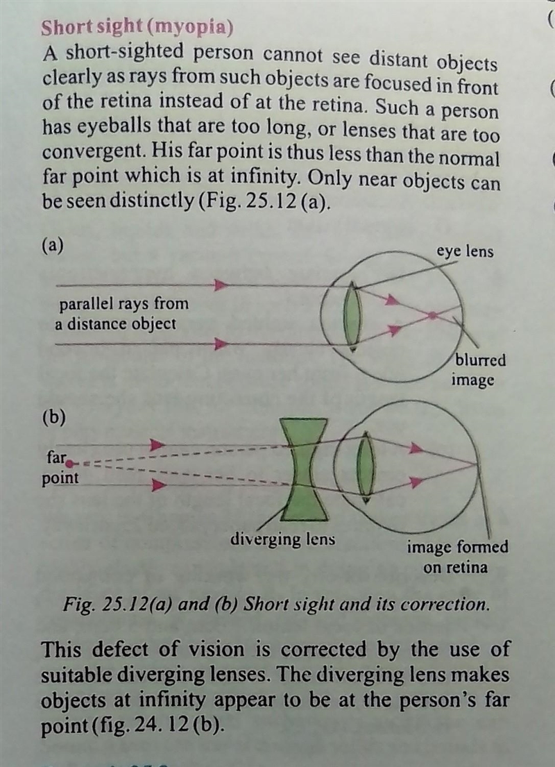 What is myopia and hypermetropia?​-example-2