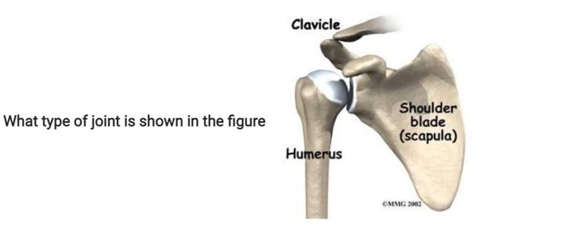 What type of joint is shown in the figure-example-1