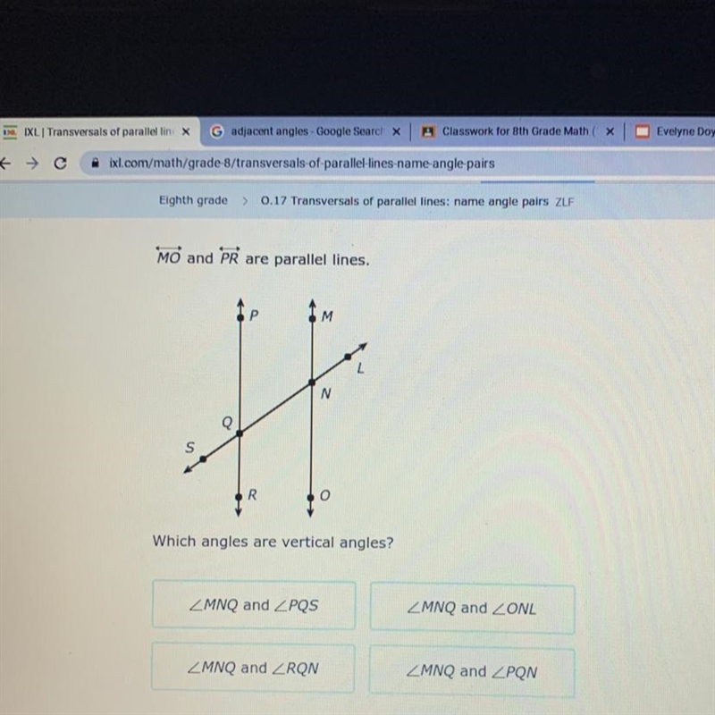 What angles are vertical angles?-example-1