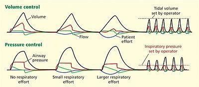 Demonstrated the knowledge of control ventilation-example-1