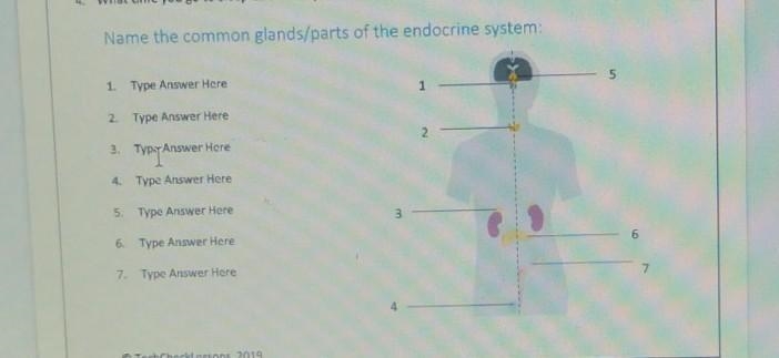 Name the common glands/parts of the endocrine system: ​-example-1