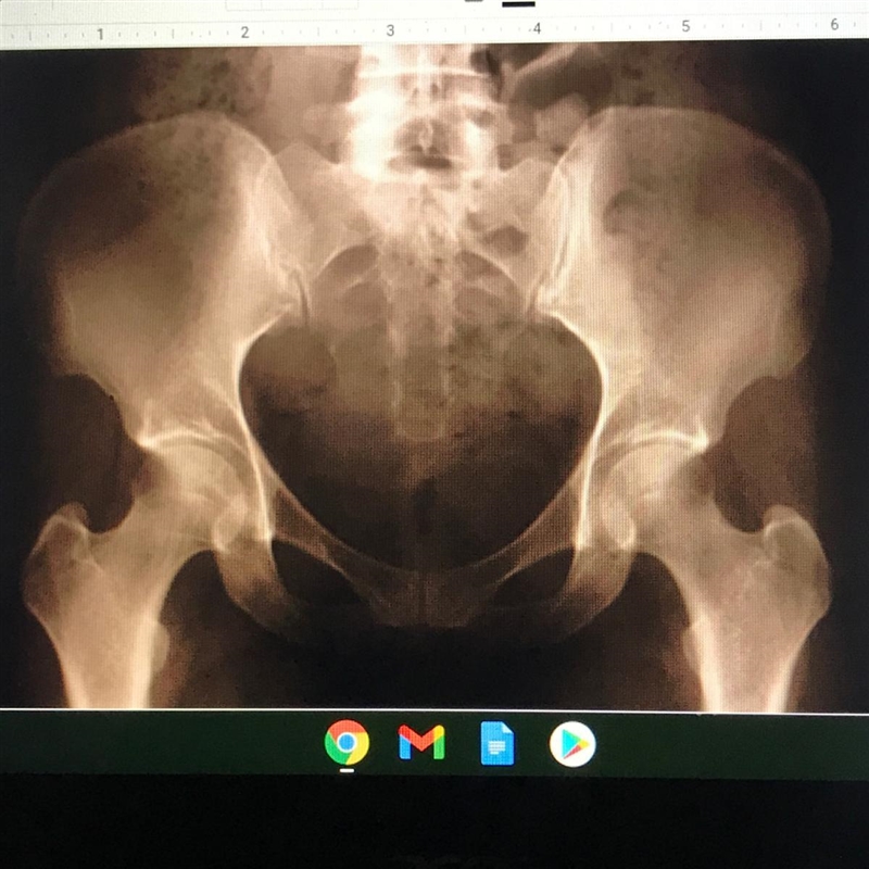 Name of joint: Type of joint : Bone 1: Bone 2: Bone 3:-example-1