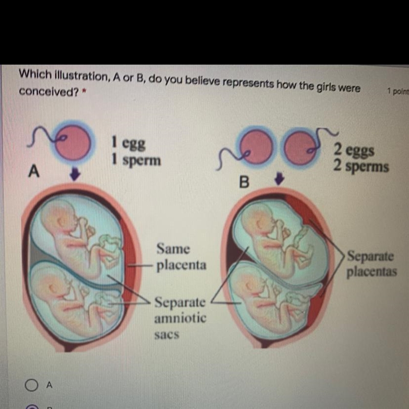 Which illustration, A or B, do you believe represents how the girls were conceived-example-1