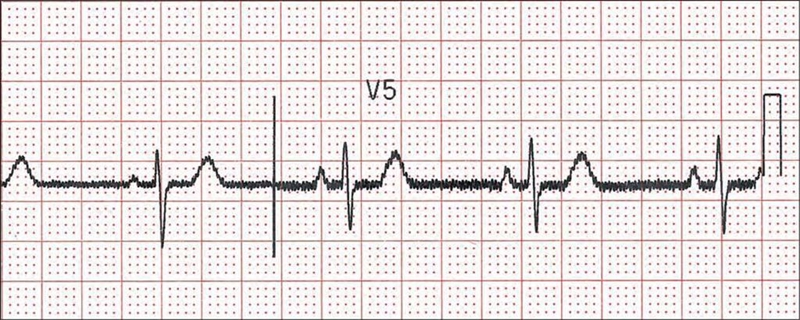 What name is this ekg-example-1