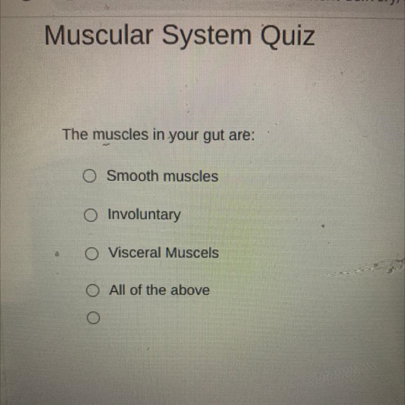 The muscles in your gut are: Smooth muscles Involuntary Visceral Muscels All of the-example-1