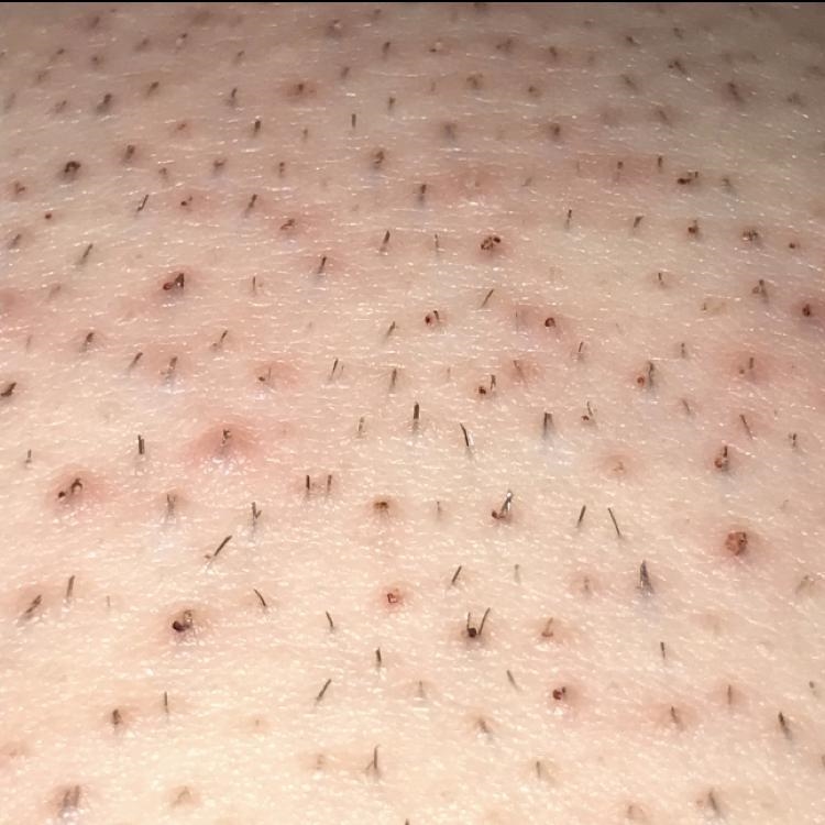 Can someone please tell me what this is I just shaved for the first time a few days-example-1