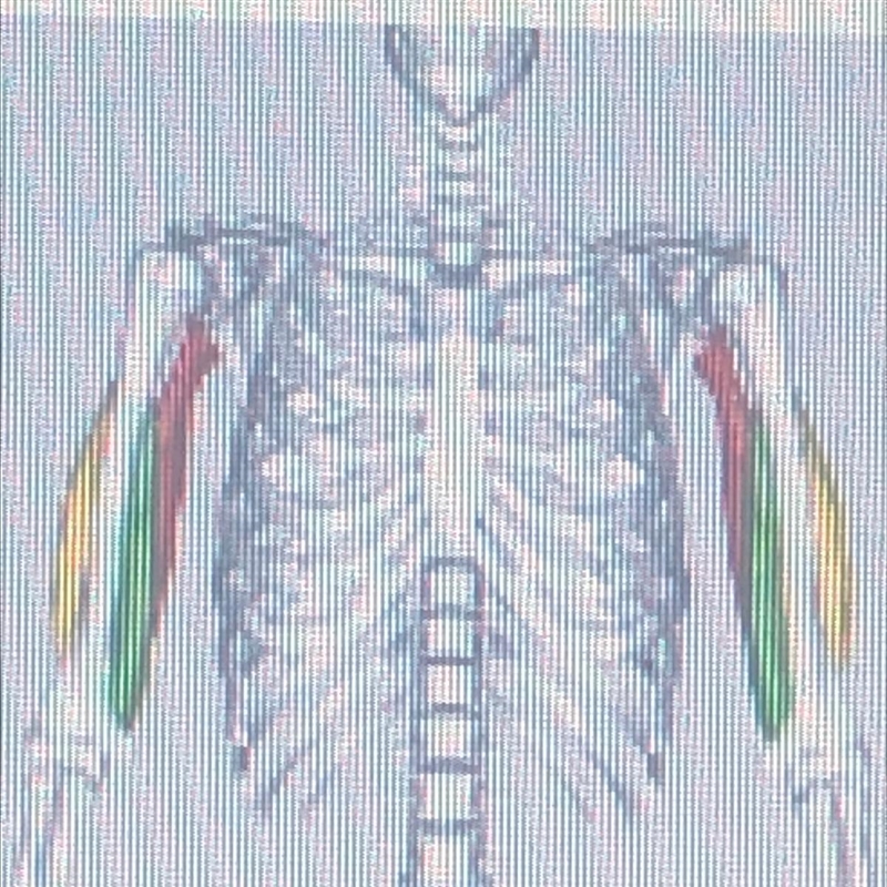 Which muscle is displayed in the picture?-example-1