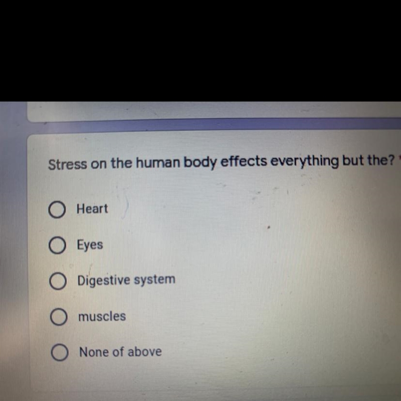 Stress on the human body effects everything but the? * pls help-example-1