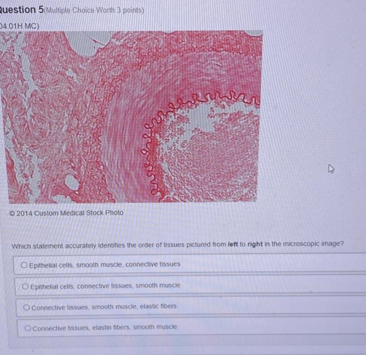 Which statement accurately identifies the order of tissues pictured from left to right-example-1