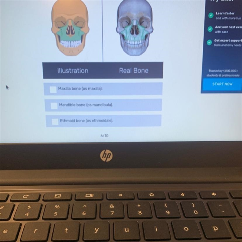 Identify the skull bone-example-1