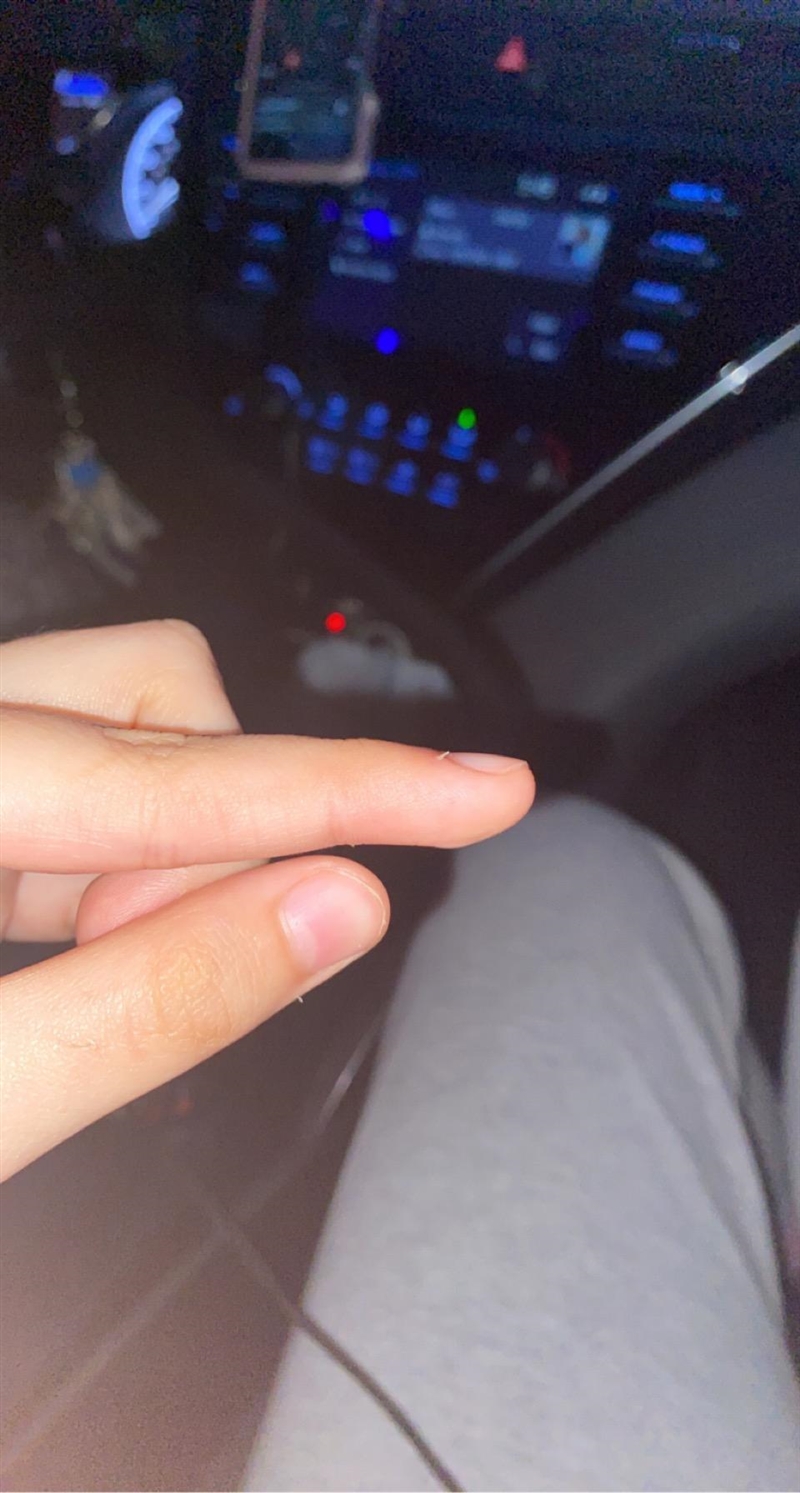 what is this thing on my finger called and what is it in general? this really isn-example-1