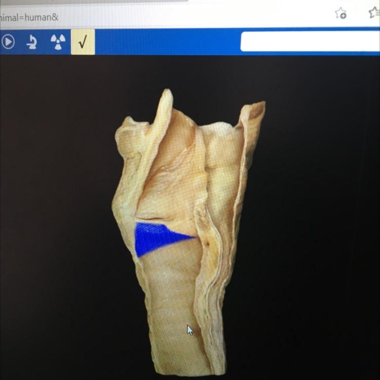 What structure is highlighted? A. Conus elasticus with mucosa B. Vocal fold c Inferior-example-1