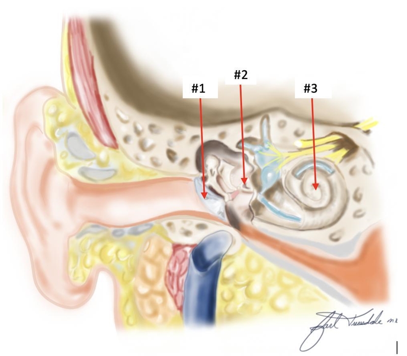 Question 1 What are the correctly identified anatomic landmarks in the ear diagram-example-1