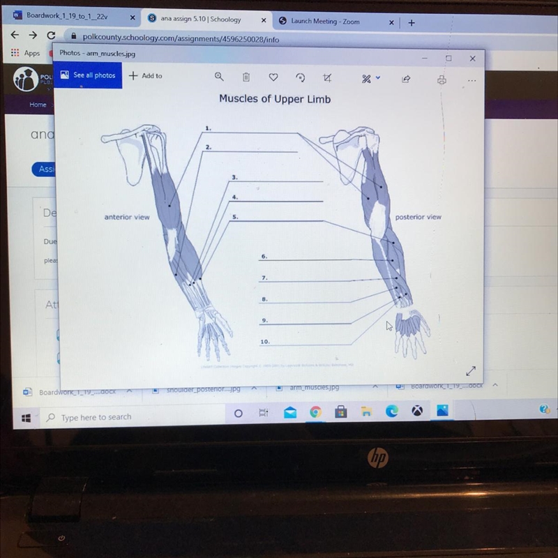 Muscles of Upper Limb Home 1. and 2. Assi 3. 4 De anterior view 5 posterior view Due-example-1