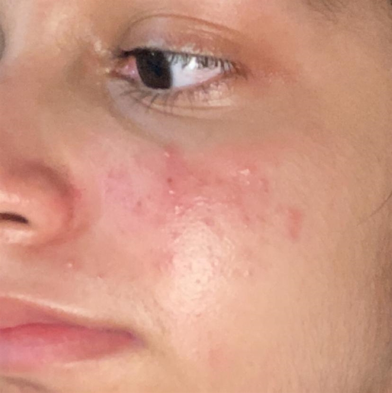 Skincare I have this on my for more than 4 months ig. It’s not improving. Can anybody-example-1