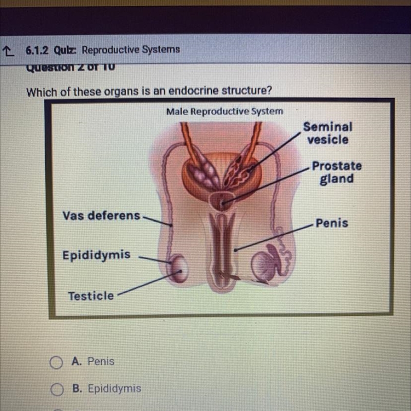 Please help ASAP !! “Which of these organs is an endocrine structure?”-example-1