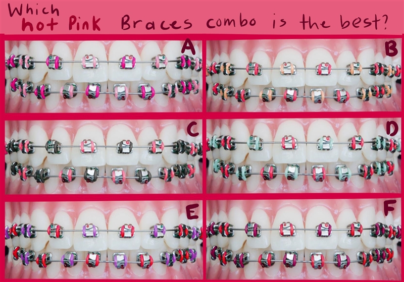 Which Hot Pink braces color combo is the best!? Getting the most popular! (20 points-example-1