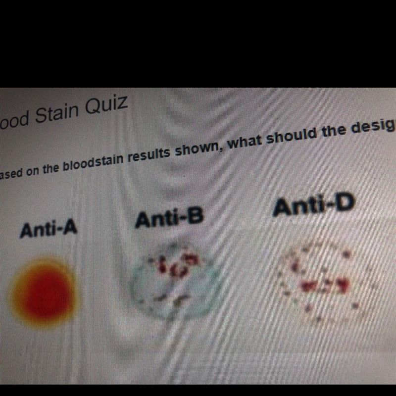 Based on the bloodstain results shown, what should the designated blood type be? Anti-example-1