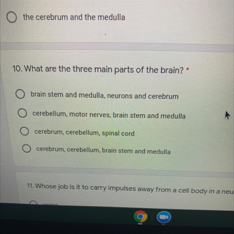 Which of the following is a part of the nervous-example-1