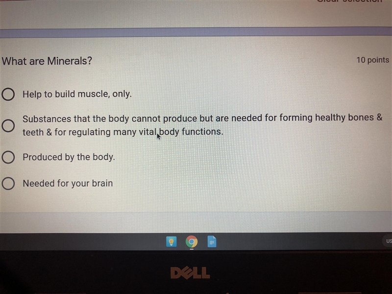 It the answer choice B? I don’t want to get this wrong.-example-1