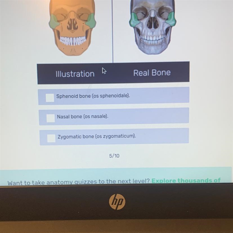 Identify the skull bone-example-1