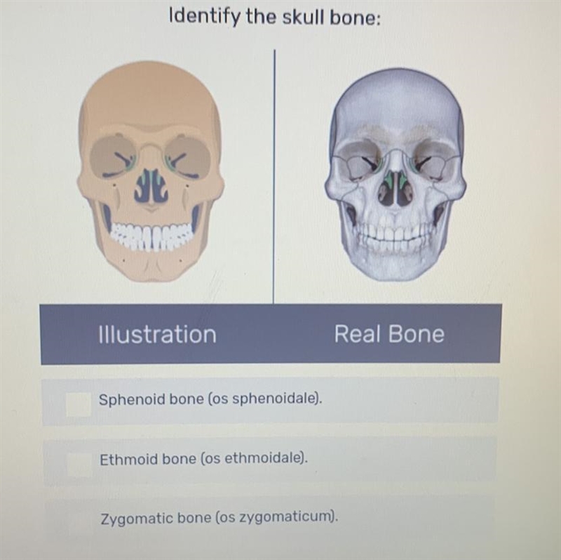 Identify the skull bone-example-1