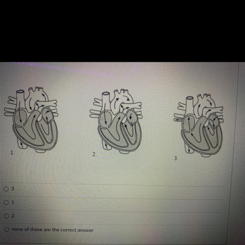 Study the 3 diagrams below. Identify the diagram that shows the correct path that-example-1