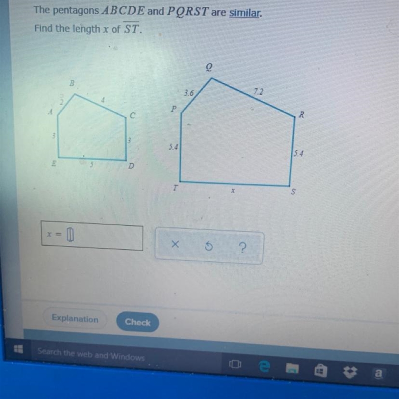 Find the Length of ST-example-1