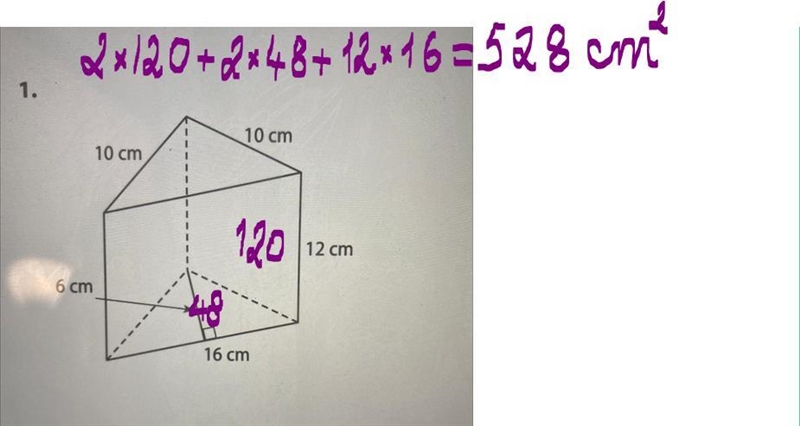 Find the surface area of each solid figure-example-1