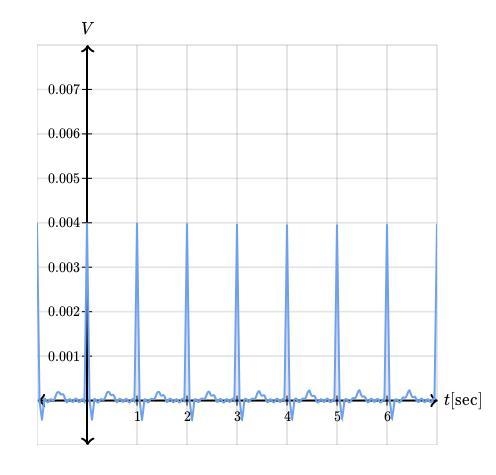 A doctor observes a graph that shows the electrical activity (in volts) of the heart-example-1