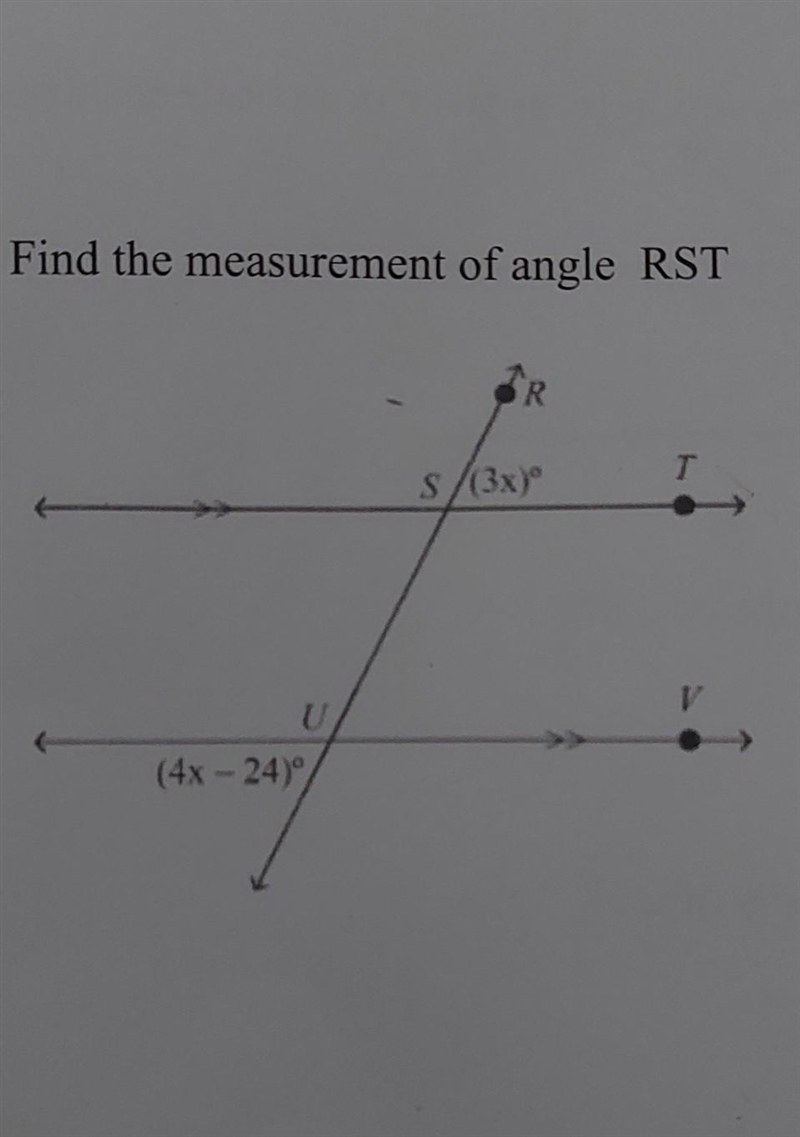 Find the measurement of angle RST​-example-1