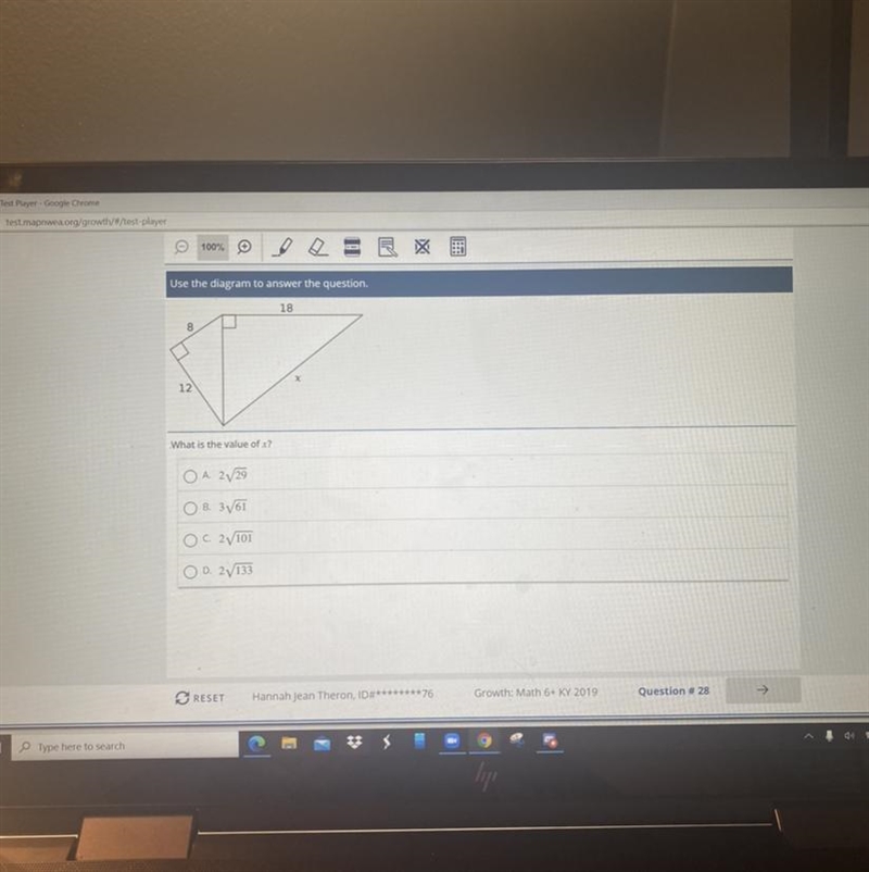 What is the value of x? a. 2 /29 b. 3 /61 c. 2/ 101 d. 2/333-example-1