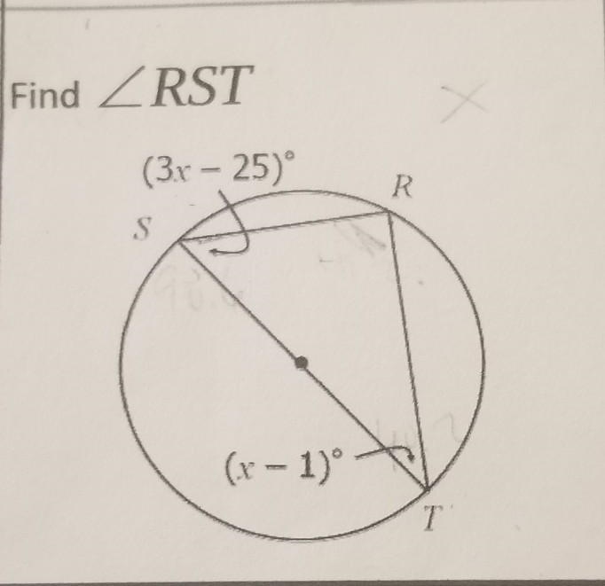 Find angle RST Please help​-example-1