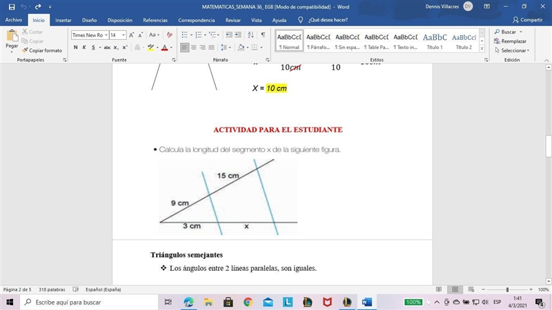 Calculates the length of the x-segment in the following figure who can help me pls-example-1