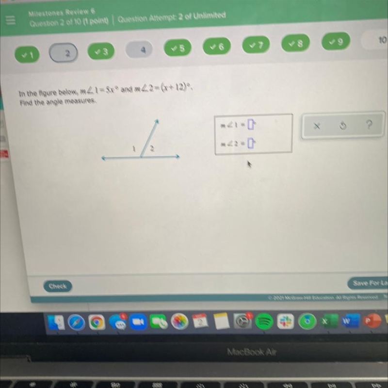 Find the angle measures.-example-1