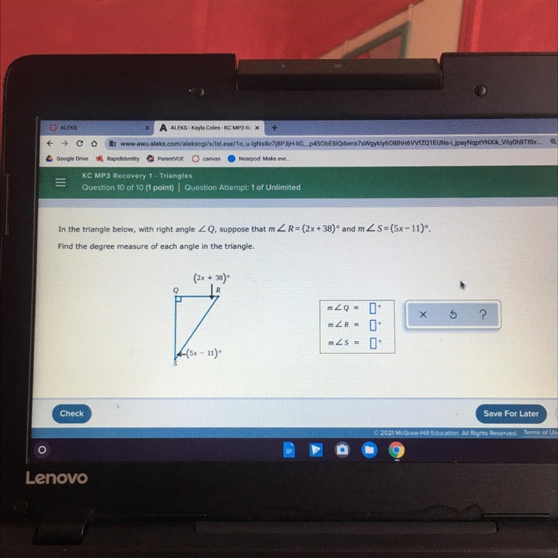 Find the degree measure of each angle in the triangle-example-1