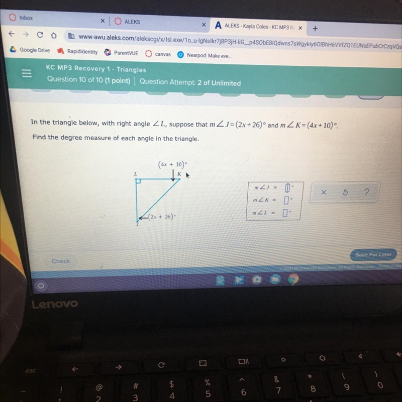 Find the degree measure of each angle in the triangle.-example-1