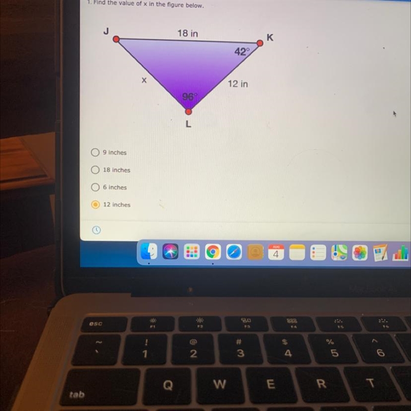 1. Find the value of x in the figure below.-example-1