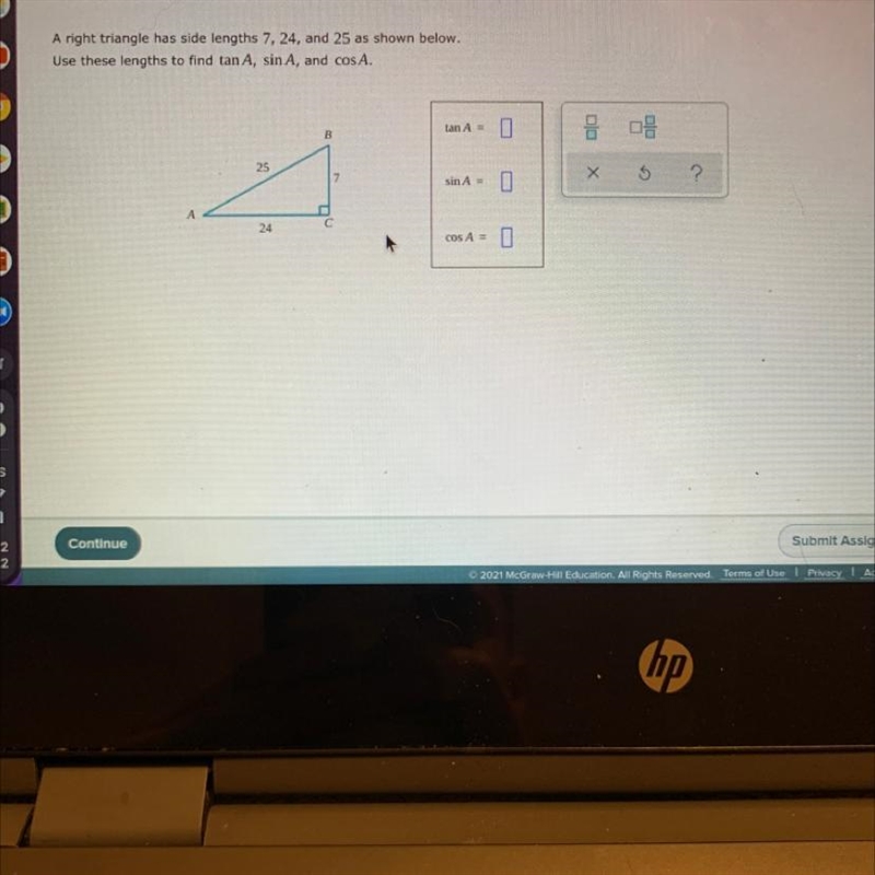 A right triangle as shown below-example-1