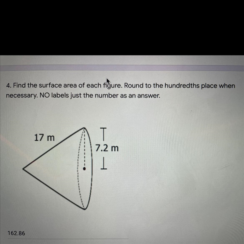 Find the surface area of each figure. round to the hundredths place-example-1