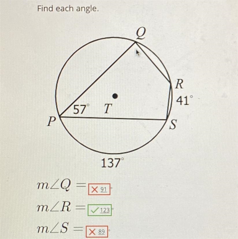 Help me find the right angles URGENT !!-example-1