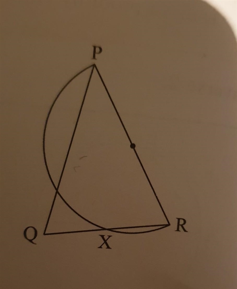 Triangle PQR is isosceles with PQ = PR. A semi-circle with diameter [PR] is drawn-example-1