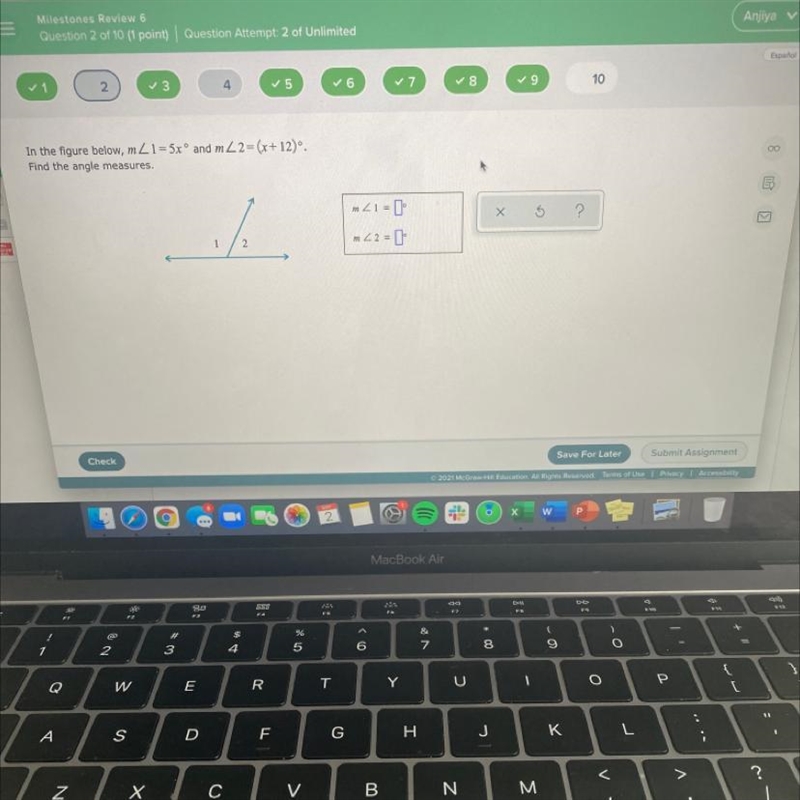 Find the angle measures-example-1