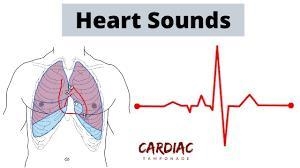 Which of the following events occur at the start of diastolic production of first-example-1