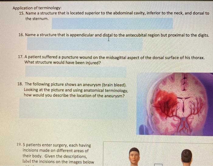 Name a structure that is on the ventral side of the heart, located more laterally-example-1