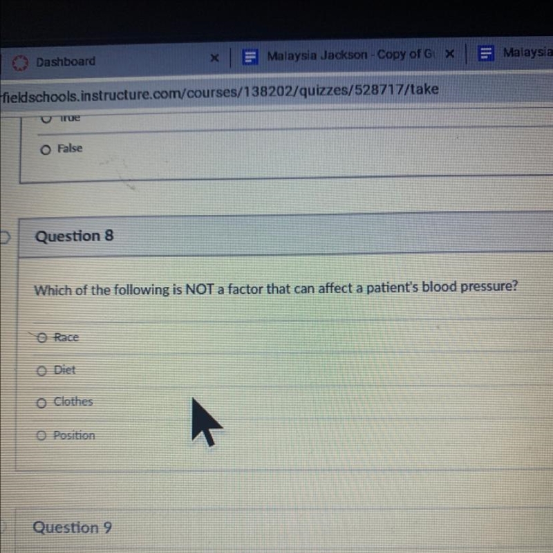 Which of the following is NOT a factor that can affect a patient's blood pressure-example-1