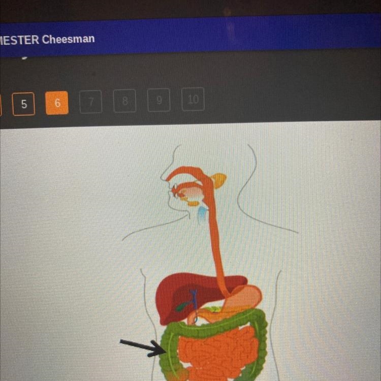 In the diagram below, which organ of the excretory system is at the end of the arrow-example-1