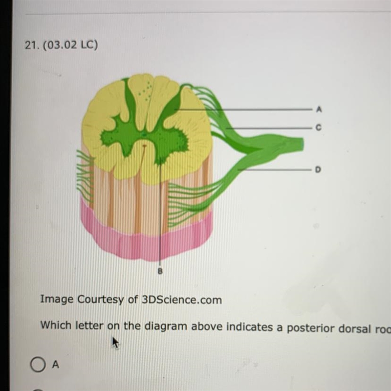 Which letter on the diagram above indicates a posterior dorsal root-example-1