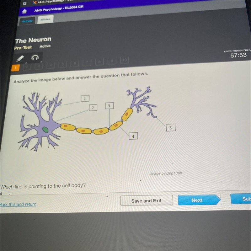 Which cell line is pointing to the body?-example-1